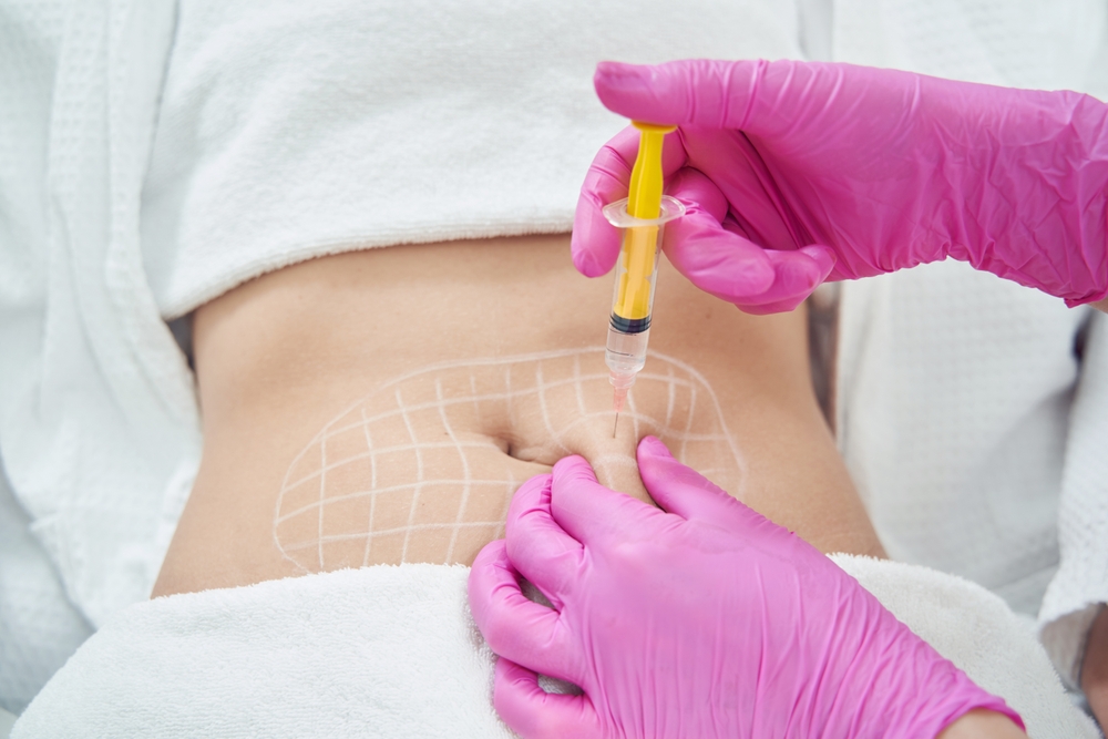 fat, dissolving, injections