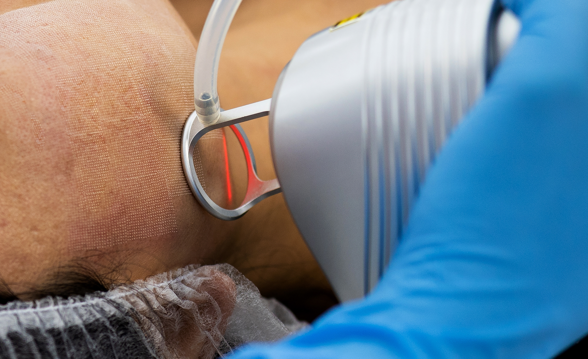 client care at beauty clinic for tummy tuck