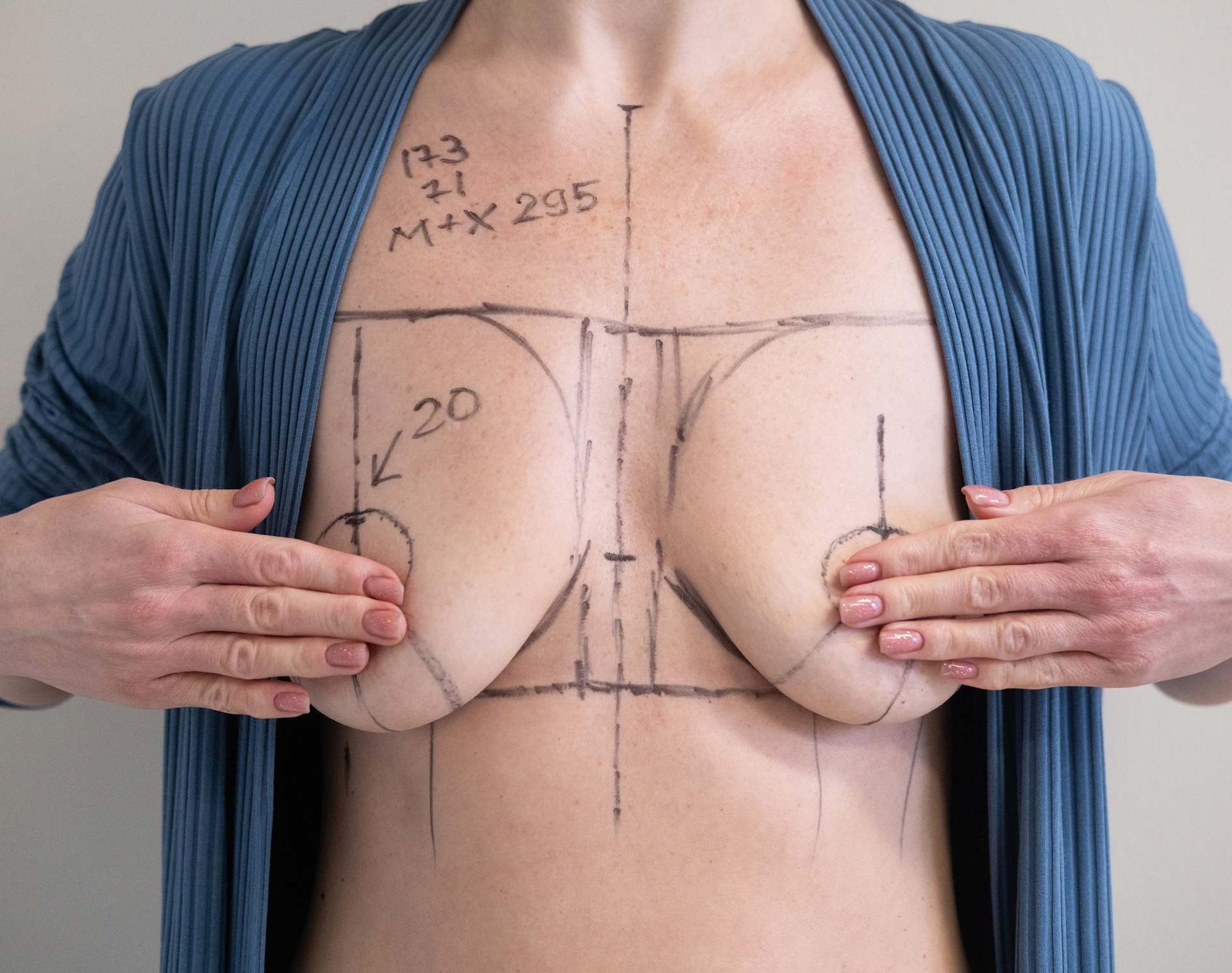 image2-breast