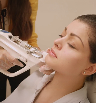 IPL Photofacial